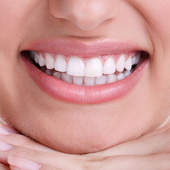 cosmetic dentist near me teeth whitening