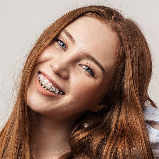 dental office San Bernardino Six Month Smiles