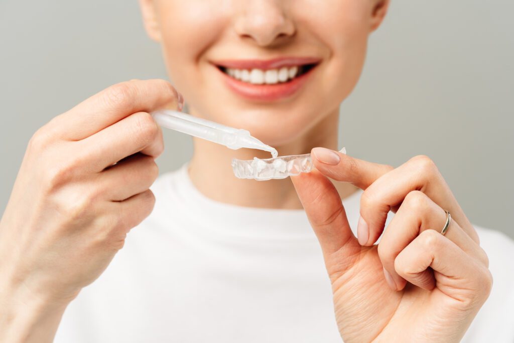teeth whitening trays cosmetic dentist San Bernardino