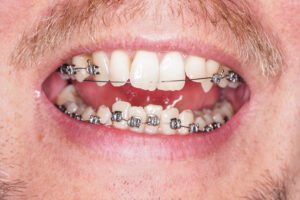 - My Dentist and Orthodontist