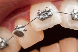 - My Dentist and Orthodontist