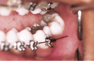 - My Dentist and Orthodontist